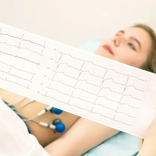 Examen Electrocardiograma